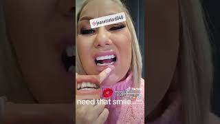 NEEDTHATSMILE CLIP IN VENEERS CLIP ON TEETH SNAP ON SMILE INSTANT SMILE screenshot 3