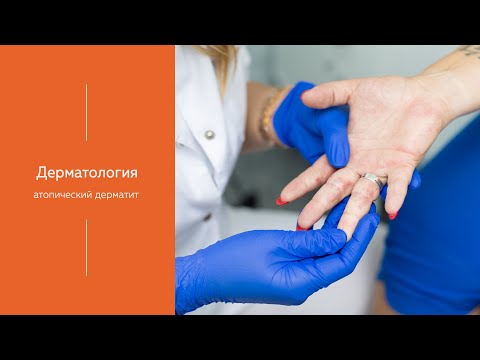 Атопический дерматит | МЕДИЦЕНТР