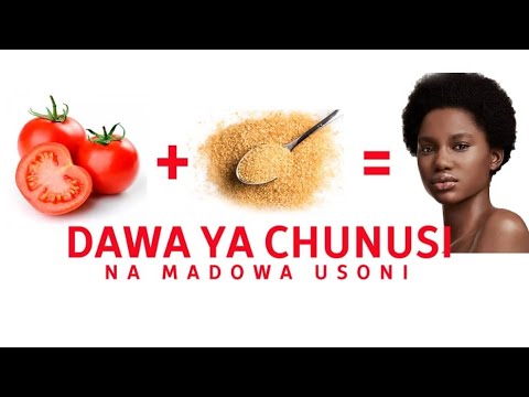 Video: Wasichana Walionyesha Chunusi Na Mafuta Kwenye Kikundi Kipya Cha #COMNOUSAllSo. Madaktari Walipiga Kengele