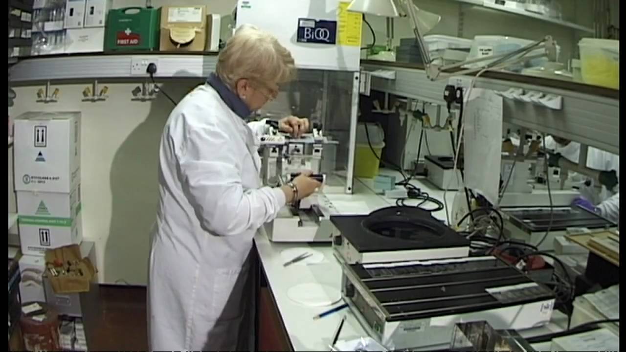 Scientists ask for brain donations