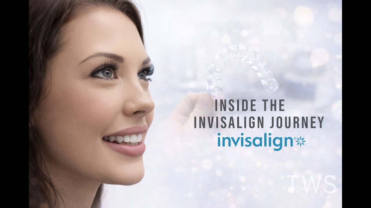Invisalign Ridge Inside Inside an Invisalign Journey | From Consultation to Final Smile - YouTube