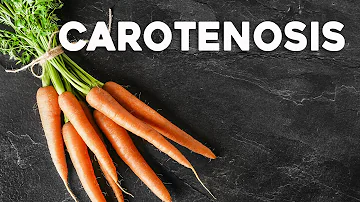Is the skin of a carrot good for you?