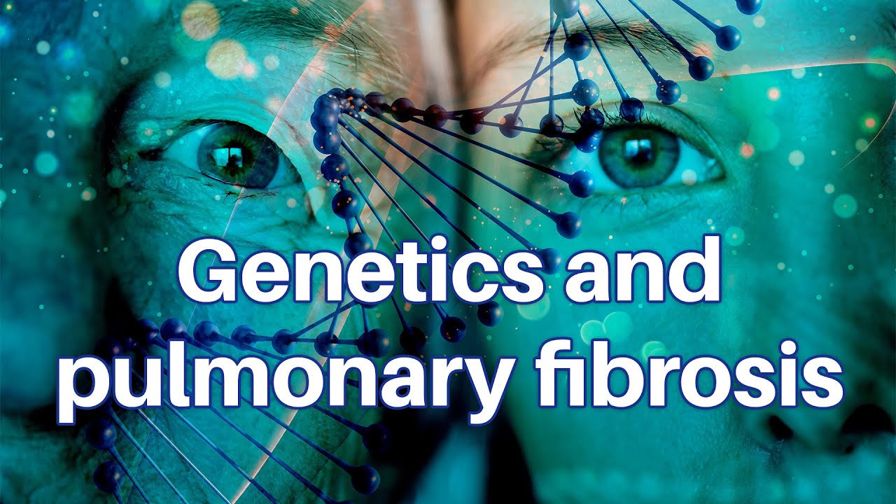 Genetics and Beyond: Exploring Interstitial Lung Disease in Families and Individuals