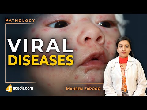 Viral Diseases | Smallpox | Pathology Video | Medical Education Channel | V-Learning