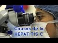 Causas de hepatitis C