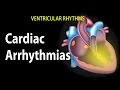 Cardiac Arrhythmias, Animation