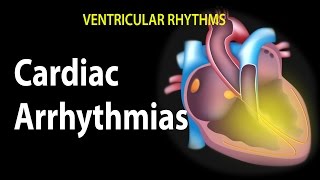 Cardiac Arrhythmias, Animation