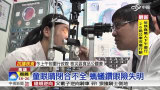 螞蟻鑽眼! 男童蜂窩性組織炎險瞎│中視新聞 20161225