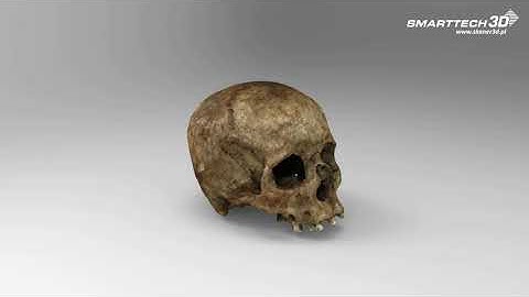 SMARTTECH3D - Human skull digitalization