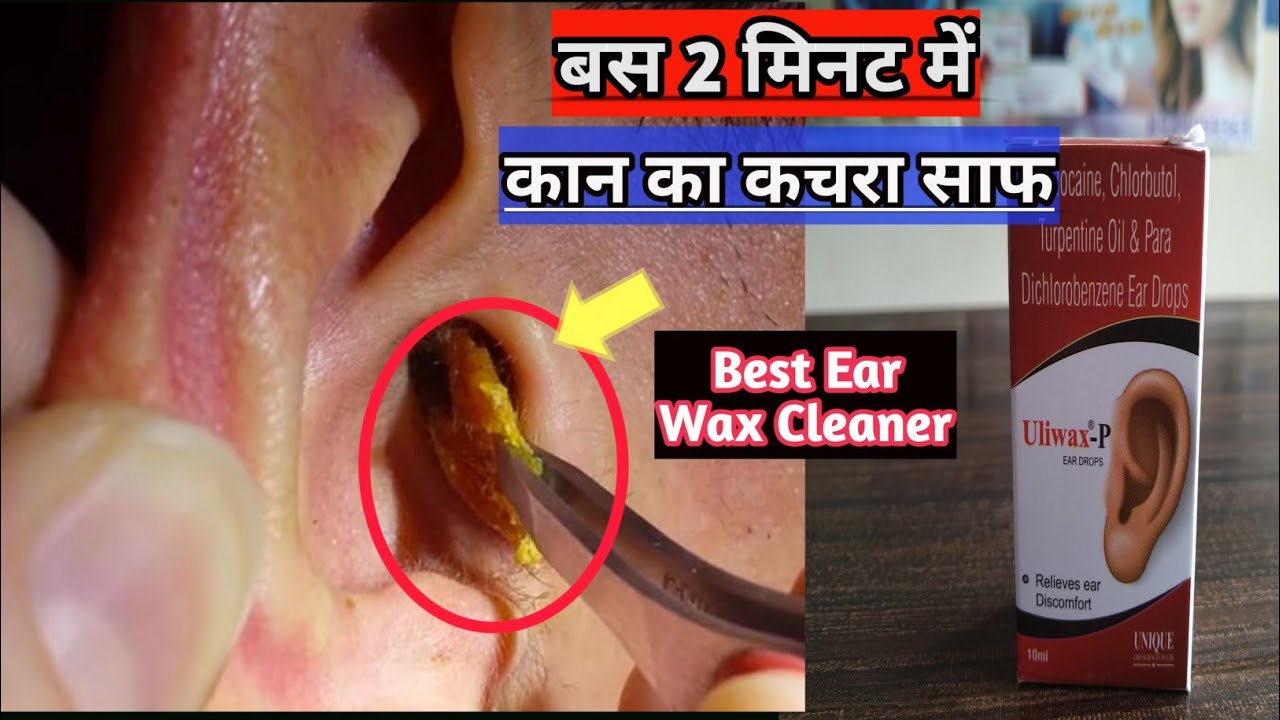 क न क कचर कर ब हर 2 म नट म Uliwax P Ear Drops Best Earwax Drops Medicaljankari Youtube