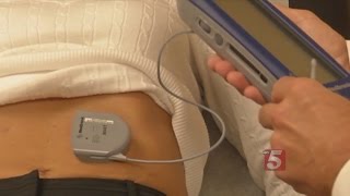 Gastric Pacemaker To The Rescue