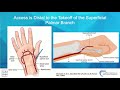Distal Radial State of the Art-Ethan Korngold, MD