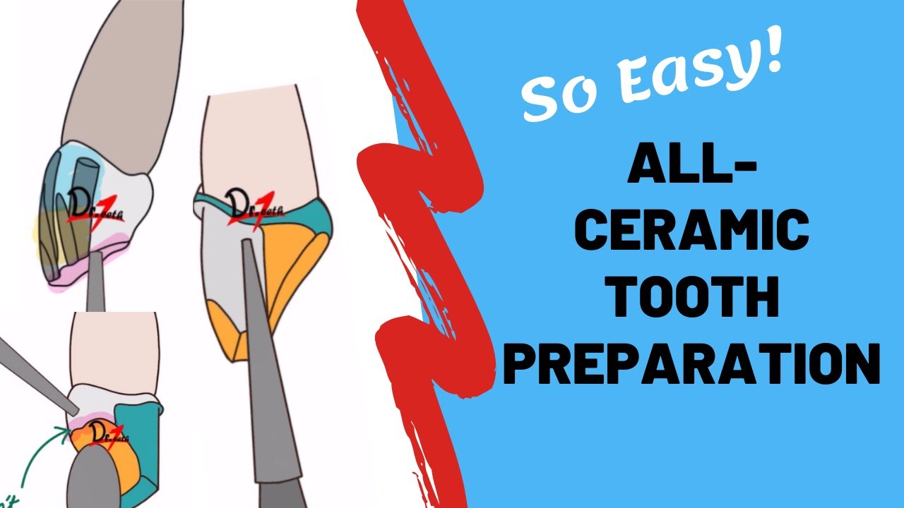 健康・医学 The Tooth Preparation Easy Technique for Tooth Preparation with Detailed Explanation