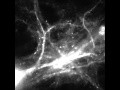 The molecular basis of memory tracking mrna in brain cells in real time
