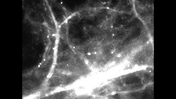 The Molecular Basis of Memory: Tracking mRNA in Brain Cells in Real Time