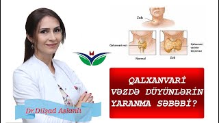 Qalxanvari vəziə düyünlərin yaranma səbəbi BUDUR!!!      Dr.Dilşad Aslanlı