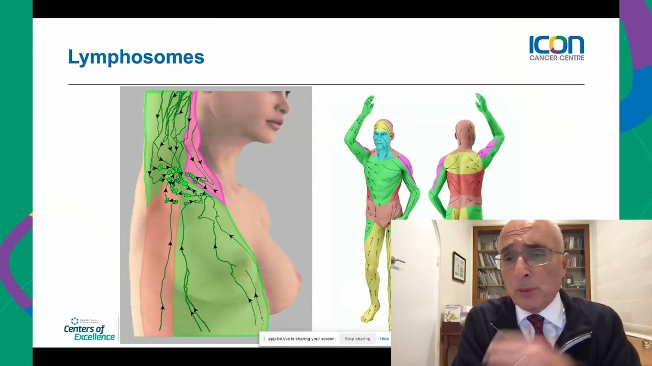 Icon Cancer Centre Facebook Live | Understanding and managing Lymphedema