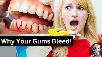 Bleeding Gums: Bleeding Gums? Here’s How to Stop It FAST! 🩸🦷