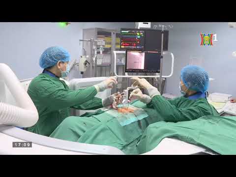 Video Điều trị Bơm xi măng xẹp đốt sống - YouTube