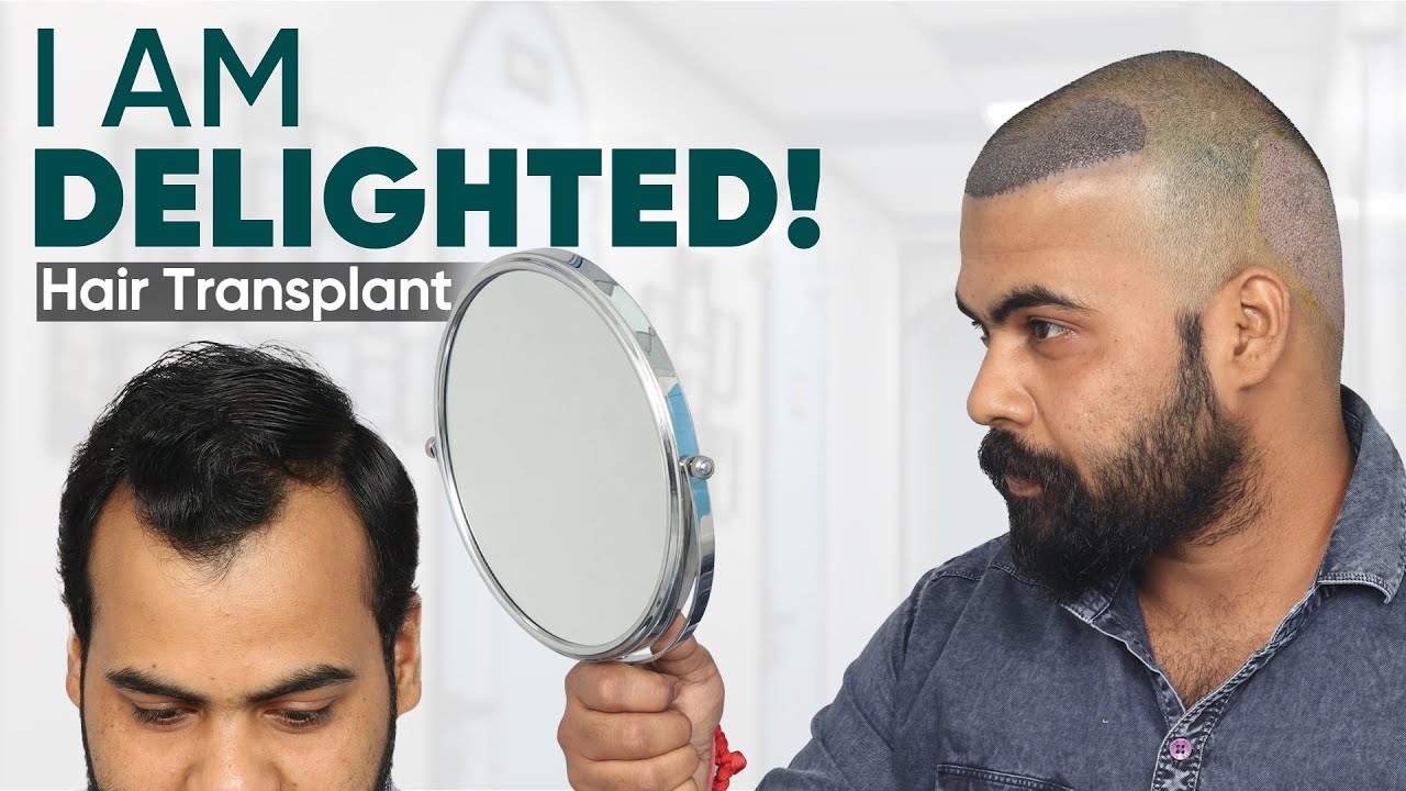Hair Transplant in Kota | Best Results & Cost of Hair Transplant in Kota