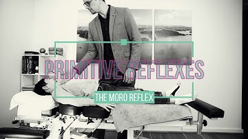 Testing for a Persistent MORO reflex (Moro Test, Crossover Balancing, Pigeon/Duck Walk)