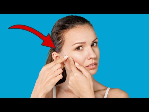 NEVER make THESE 6 Mistakes when Squeezing Pimples 💥 (You won´t expect THIS) 🤯