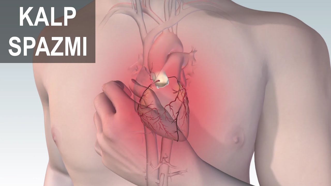 Kalp Spazmı 2 Kalp Spazmı