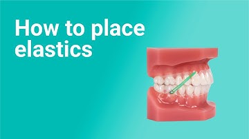 How to Place Elastics with Clear Aligners (9 Ortho Pro techniques)