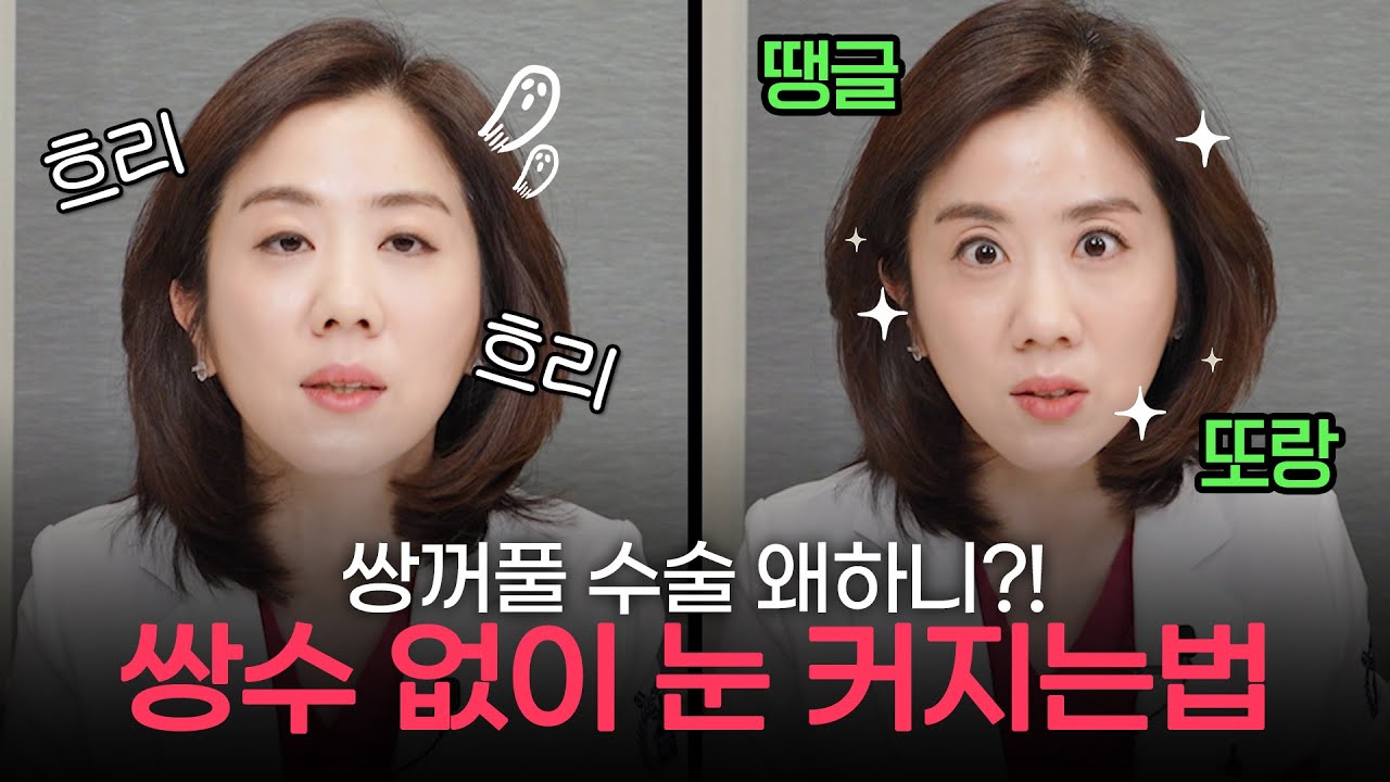 [Оллитинг гоо сайхны мэс заслын клиник] Мэс засал хийлгэсэн нь мэдэгдэхгүйгээр нүдээ томсгох арга байхгүй юу?! | Оллитинг гоо сайхны мэс засал