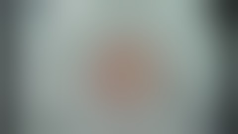 EndoGlide Ultra Thin Surgery