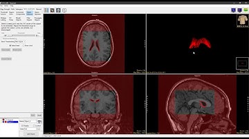 Analyze 14.0 - Segment: Subregion