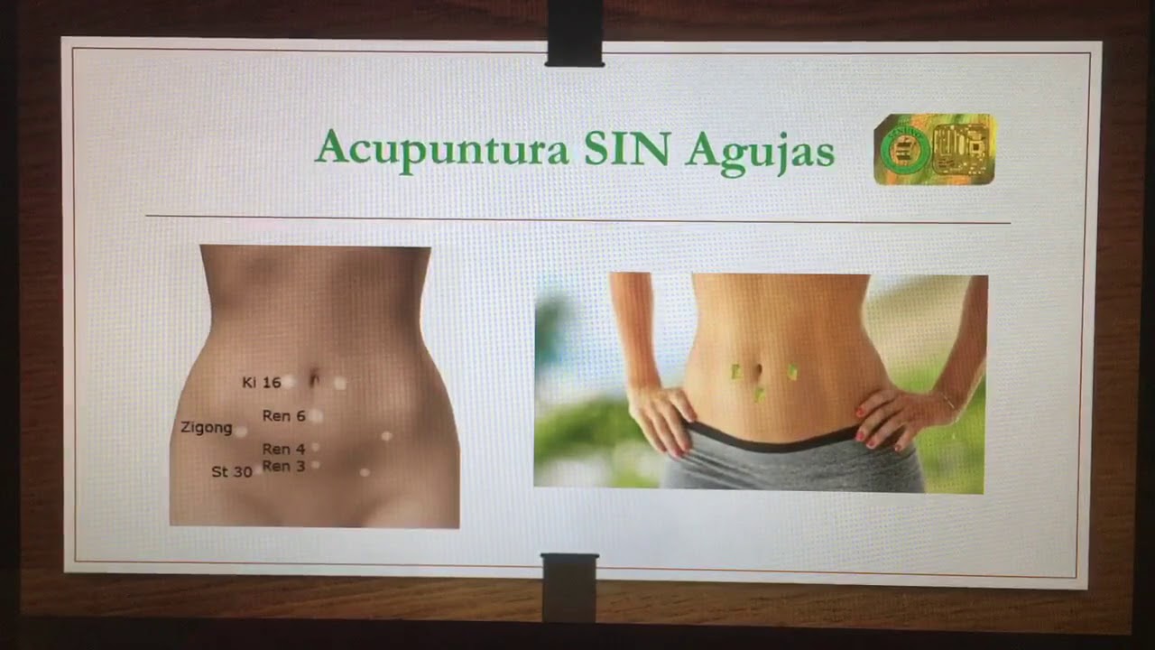 Auriculoterapia para adelgazar en californien