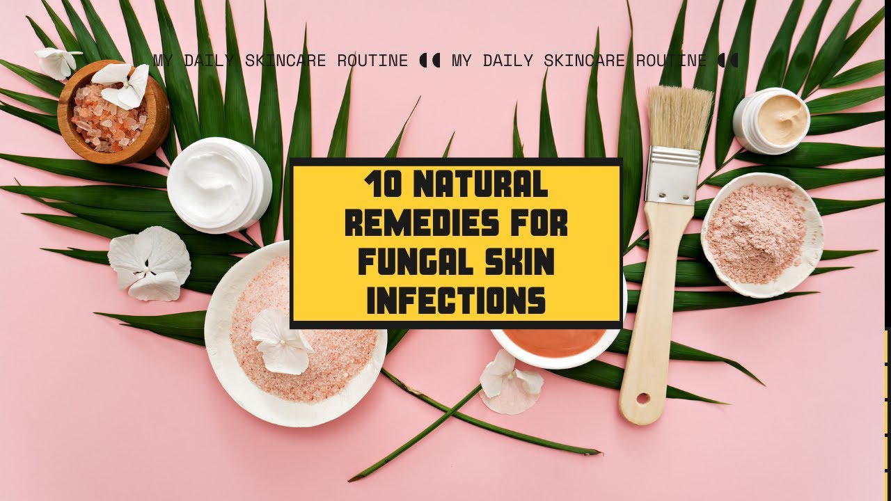 10 Natural Remedies for Fungal Skin infections YouTube