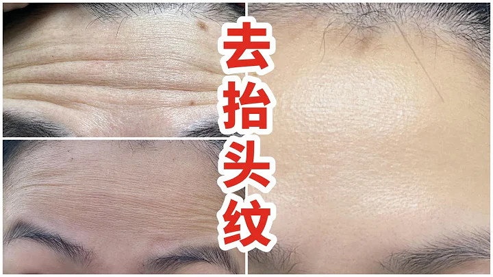 0成本 6分鐘消滅抬頭紋 日本超快速擺脫額頭深紋操 - 天天要聞