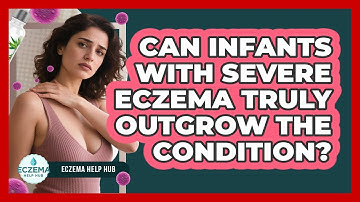Can Infants With Severe Eczema Truly Outgrow The Condition? - Eczema Help Hub