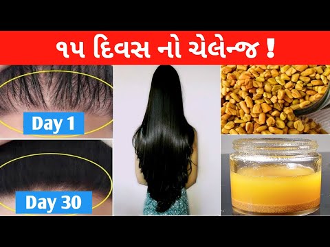 best remedy for hair, remedy for hair growth, ખરતા વાળ અટકાવવાના ઉપાયો, વાળ ખરતા અટકાવવાની રીત