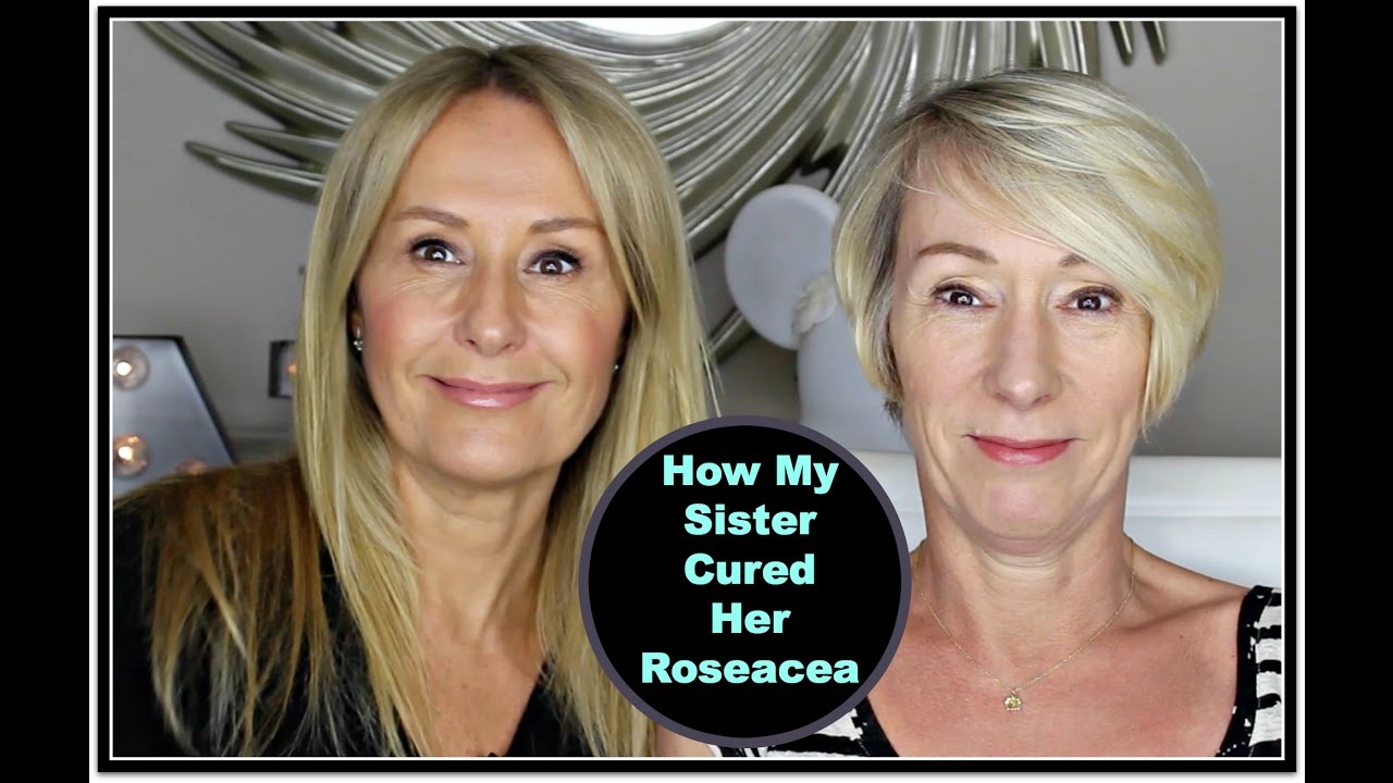 Как моя сестра вылечила розацеа — Надин Бэгготт