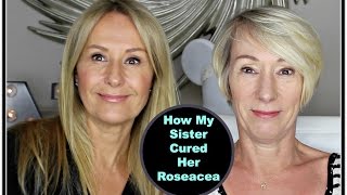 How My Sister Cured Her Rosacea - Nadine Baggott