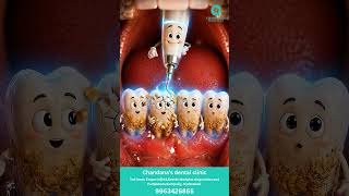 gbt teeth cleaning in low price in telugu | Instant Teeth whitening treatment | Chandana'S Dental