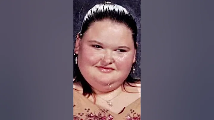Amy Slaton before & after 1000lb Sisters #shorts