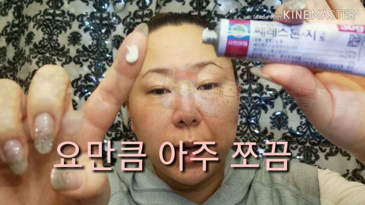 Steroidcream 얼굴에 난 두드러기 일주일만에 극복하기.Get rid of hives on your face in a week.