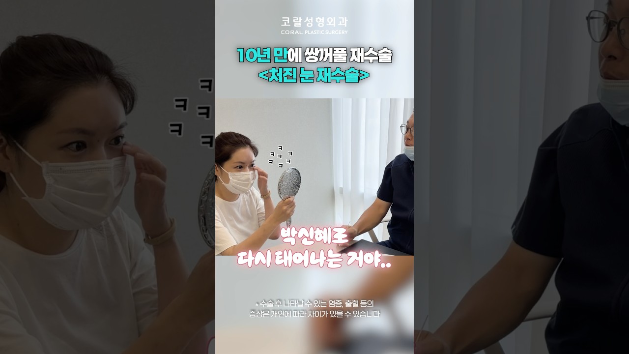 10년 만에 쌍꺼풀 재수술👀 처진 눈의 변화는? #shorts #쌍수