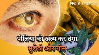 Jaundice Treatment at Home | पीलिया को खत्म कर देगा मुलेठी और नीम | Fit Hai Toh Hit Hai screenshot 3