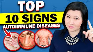 The Top 10 Surprising Signs of Autoimmune Diseases  A Rheumatologist's Guide