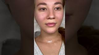 Контурная пластика губ👄