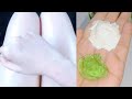 Hand and feet whitening cream home remedy | Hand whitening | Get fair hands and feet whitening tips