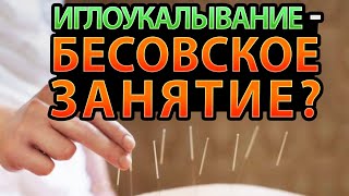 Иглоукалывание - это бесовское занятие?