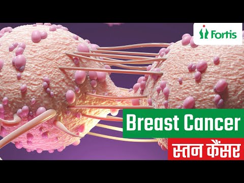 स्तन कैंसर (Breast Cancer) | कारण | लक्षण | उपचार | Dr Uma Dangi | Fortis Mumbai