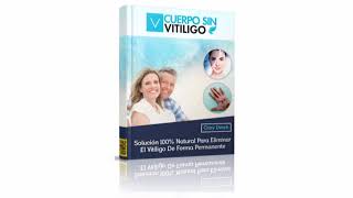 Cuerpo Sin Vitiligo pdf Gary Derek ¿En verdad funciona Cuerpo Sin Vitiligo Pdf Gary Derek?