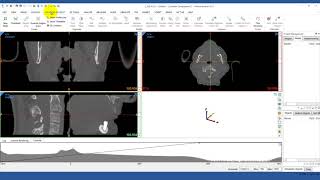 How to Import DICOM Images into Mimics | Mimics Innovation Suite screenshot 4